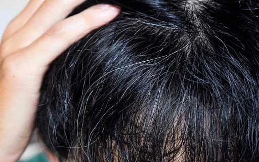 آیا می توانید از سفید شدن موها جلوگیری کنید؟